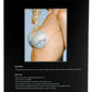 XB091 SL Sequin Adhesive Bra - Silver - Bossy Pearl